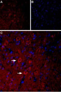 Anti-5HT3A Receptor (HTR3A) Antibody