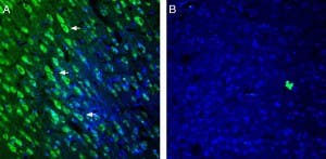 Anti-5HT2A Receptor (HTR2A) (extracellular) Antibody