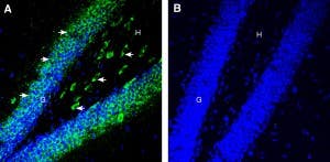 Anti-5HT6 Receptor (HTR6) (extracellular) Antibody