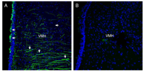 Anti-Semaphorin 4A (SEMA4A) (extracellular) Antibody