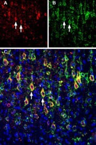 Anti-Slitrk1 (extracellular) Antibody