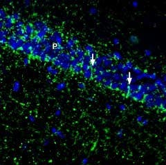Anti-SVCT2/SLC23A2 (extracellular) Antibody
