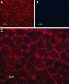 Anti-TRIC-A (TMEM38A) Antibody