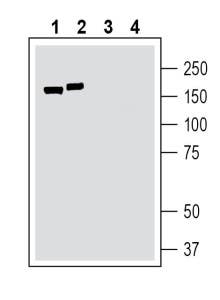 Anti-TMC1 (extracellular) Antibody