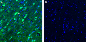 Anti-Neurokinin 2 Receptor (NK2R) Antibody