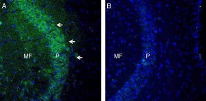 Anti-TSH Receptor (TSHR) (extracellular) Antibody