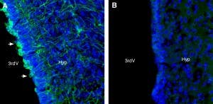 Anti-Taste Receptor Type 1 Member 3 (TAS1R3) (extracellular) Antibody
