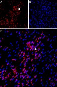 Anti-VPAC1 (VIPR1) (extracellular) Antibody