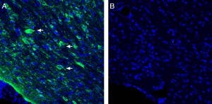Anti-Vasopressin V<sub>1A</sub> Receptor (AVPR1A) Antibody
