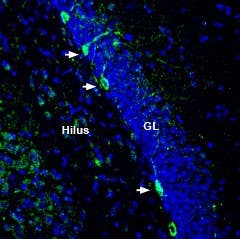 Anti-ZIP8 (SLC39A8) (extracellular) Antibody