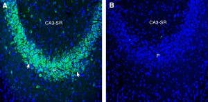 Anti-ZIP10/SLC39A10 (extracellular) Antibody