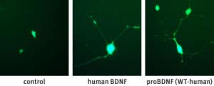 Recombinant human proBDNF protein