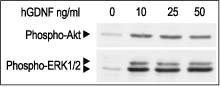 Recombinant human GDNF protein