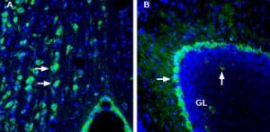 Anti-CRTH2/GPR44 (extracellular) Antibody
