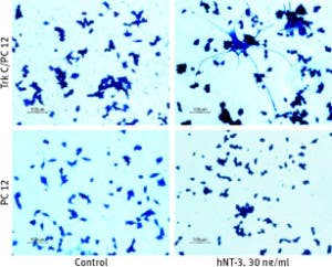 Recombinant human Neurotrophin-3 (NT-3) protein