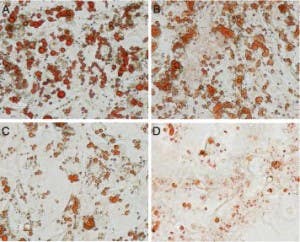 Oligomycin