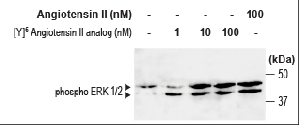 [Y]6-Angiotensin II Analog