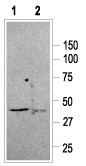 Anti-Somatostatin Receptor Type 2 Antibody - Carrier Free
