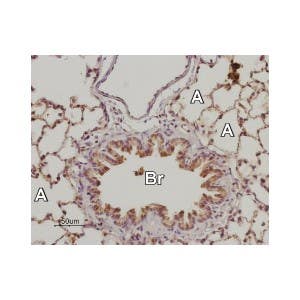Anti-Adenosine A<sub>2B</sub> Receptor (extracellular) Antibody