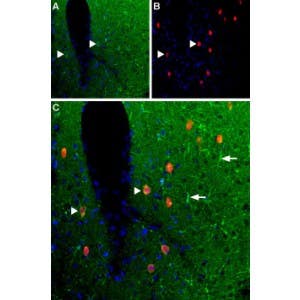 Anti-Adenosine A<sub>1</sub> Receptor Antibody