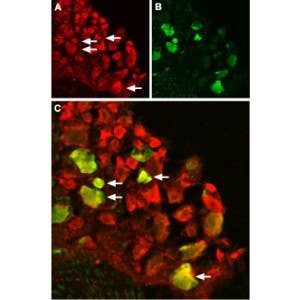 Anti-TRPV1 (VR1) Antibody