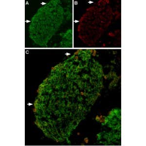Anti-TRPV2 (VRL1) Antibody