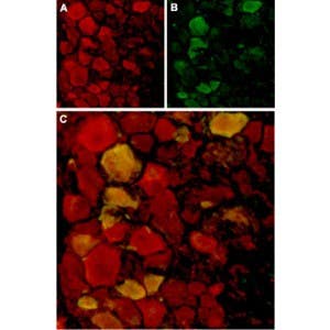 Anti-TRPV4 Antibody