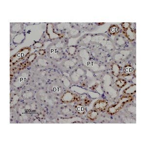 Anti-TRPV5 Antibody