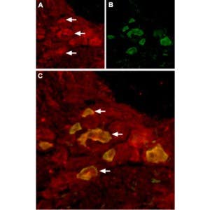 Anti-TRPV6 Antibody