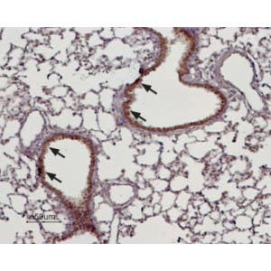 Anti-TRPM4 Antibody