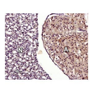 Anti-TRPM7 Antibody