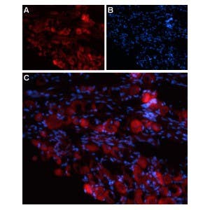 Anti-TRPV4 (extracellular) Antibody
