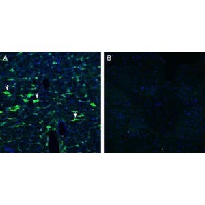 Anti-CRLR/CALCRL (extracellular) Antibody