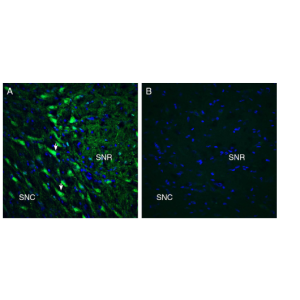 Anti-GPR55 (extracellular) Antibody