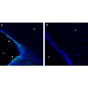 Anti-OCTN2/SLC22A5 Antibody