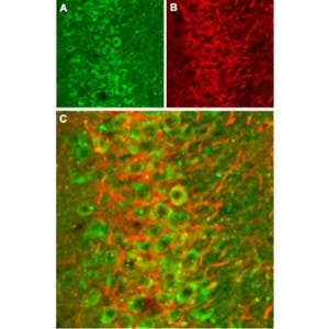 Anti-NMDAR2B (GluN2B) (extracellular) Antibody