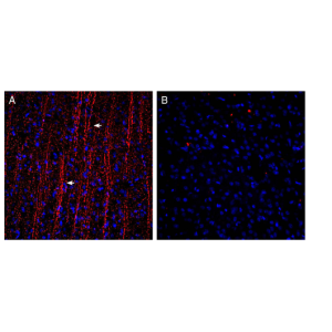 Guinea pig Anti-P2Y12 Receptor (extracellular) Antibody