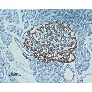 Anti-GLP1R (extracellular) Antibody