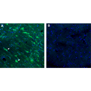 GPR88 Blocking Peptide