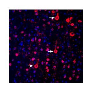 Anti-GPR17 Antibody