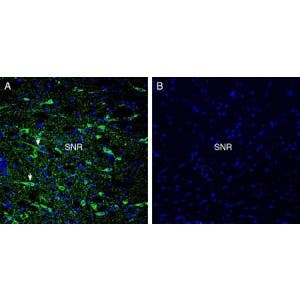 Anti-GPR52 Antibody