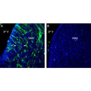 Anti-GPR139 Antibody