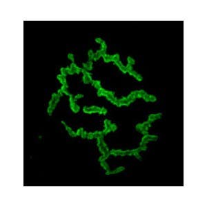 &alpha;-Bungarotoxin-FITC