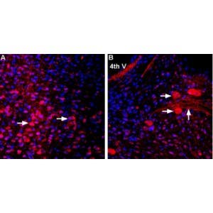 Anti-MCT2 Antibody