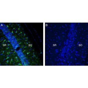 Anti-TREM2 (extracellular) Antibody