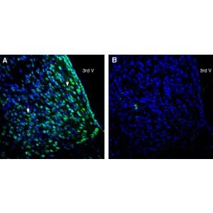 Anti-CD81 (extracellular) Antibody