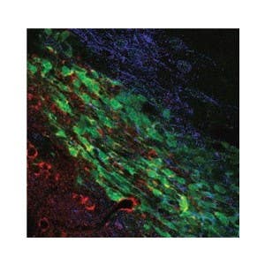 Mouse Anti-KCNN4 (K<sub>Ca</sub>3.1, SK4) (extracellular) Antibody