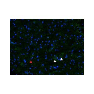 Anti-&micro;-Opioid Receptor (OPRM1) (extracellular) Antibody
