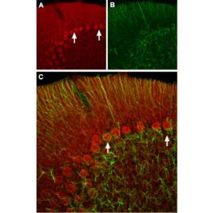 Anti-HCN2 Antibody