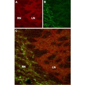 Anti-HCN4 Antibody